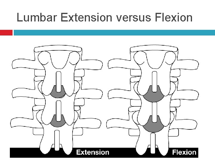 Lumbar Extension versus Flexion 