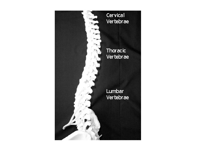 Cervical Vertebrae Thoracic Vertebrae Lumbar Vertebrae 