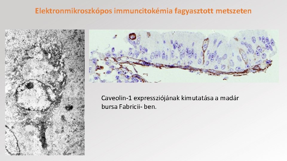 Elektronmikroszkópos immuncitokémia fagyasztott metszeten Caveolin-1 expressziójának kimutatása a madár bursa Fabricii- ben. 