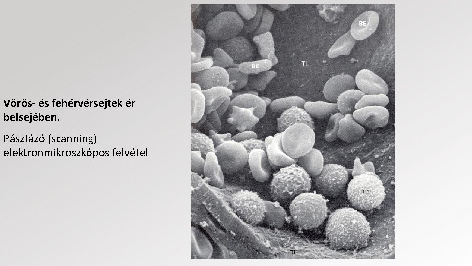 Vörös- és fehérvérsejtek ér belsejében. Pásztázó (scanning) elektronmikroszkópos felvétel 