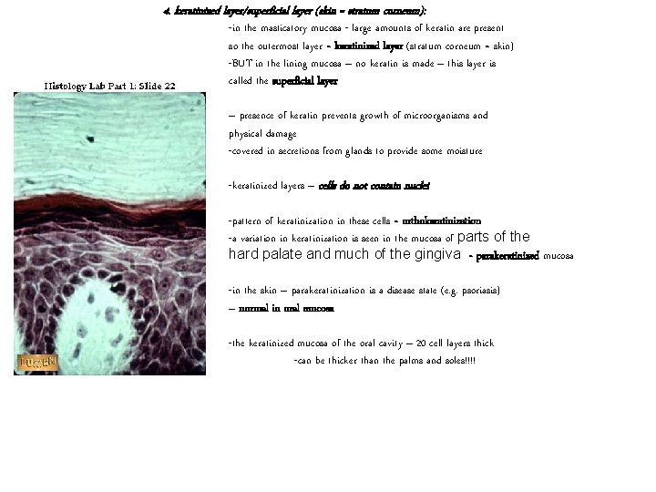 4. keratinized layer/superficial layer (skin = stratum corneum): -in the masticatory mucosa - large