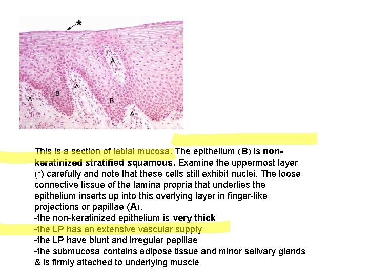 This is a section of labial mucosa. The epithelium (B) is nonkeratinized stratified squamous.