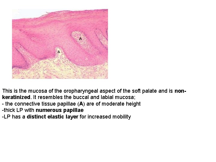 This is the mucosa of the oropharyngeal aspect of the soft palate and is