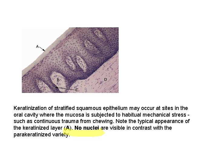 Keratinization of stratified squamous epithelium may occur at sites in the oral cavity where