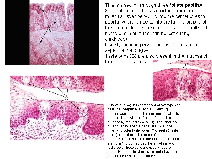 This is a section through three foliate papillae Skeletal muscle fibers (A) extend from