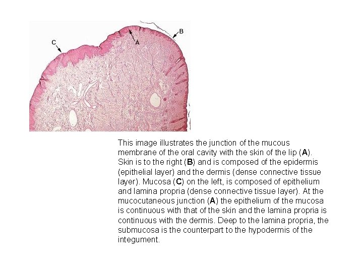 This image illustrates the junction of the mucous membrane of the oral cavity with