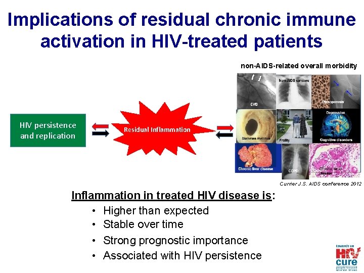 Implications of residual chronic immune activation in HIV-treated patients non-AIDS-related overall morbidity HIV persistence