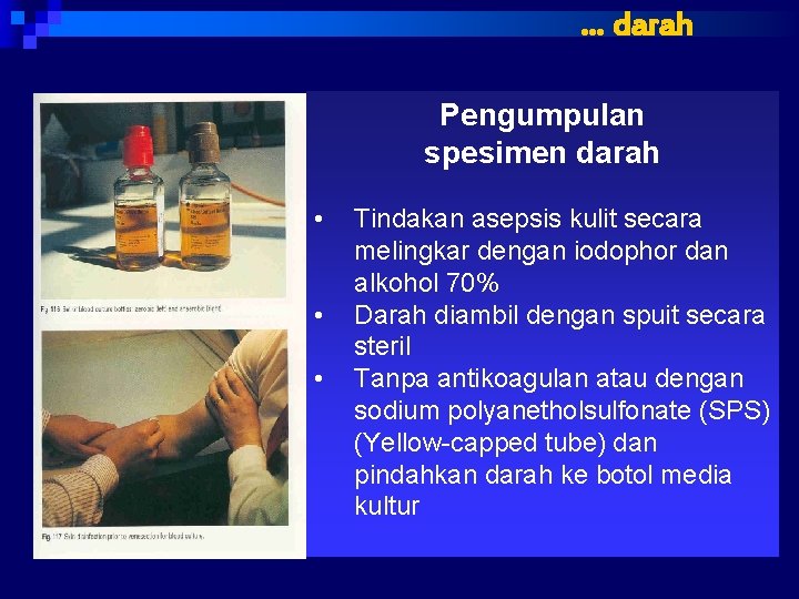 … darah Pengumpulan spesimen darah • • • Tindakan asepsis kulit secara melingkar dengan