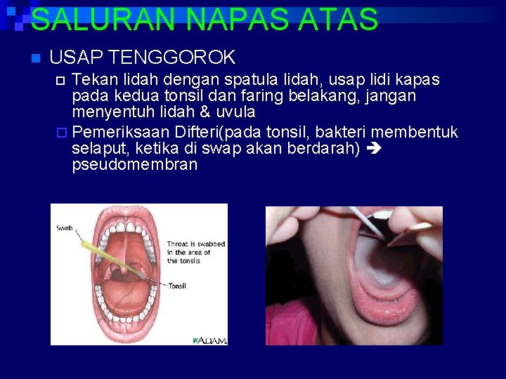 SALURAN NAPAS ATAS n USAP TENGGOROK Tekan lidah dengan spatula lidah, usap lidi kapas