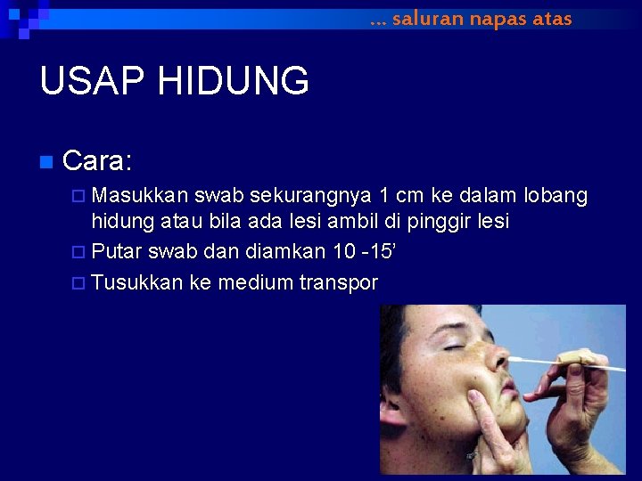 … saluran napas atas USAP HIDUNG n Cara: ¨ Masukkan swab sekurangnya 1 cm