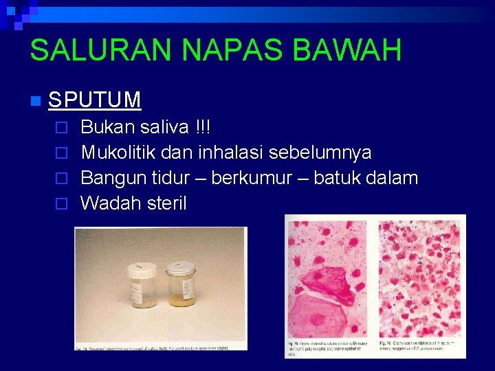 SALURAN NAPAS BAWAH n SPUTUM Bukan saliva !!! ¨ Mukolitik dan inhalasi sebelumnya ¨