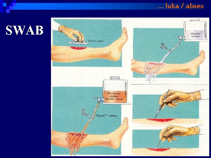 … luka / abses SWAB 