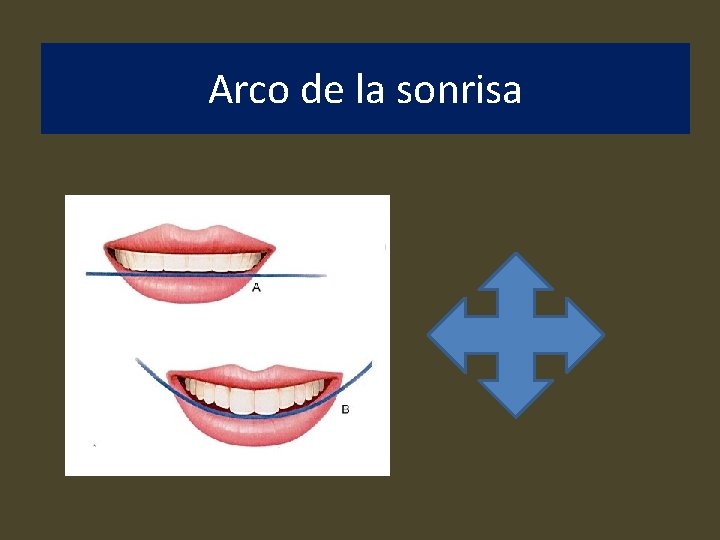 Arco de la sonrisa 