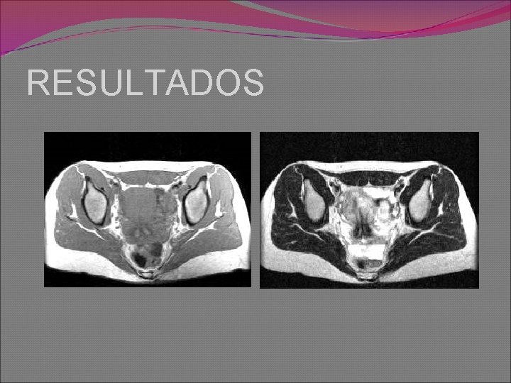 RESULTADOS 