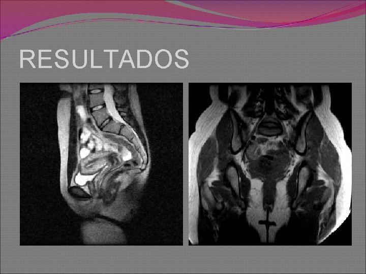 RESULTADOS 