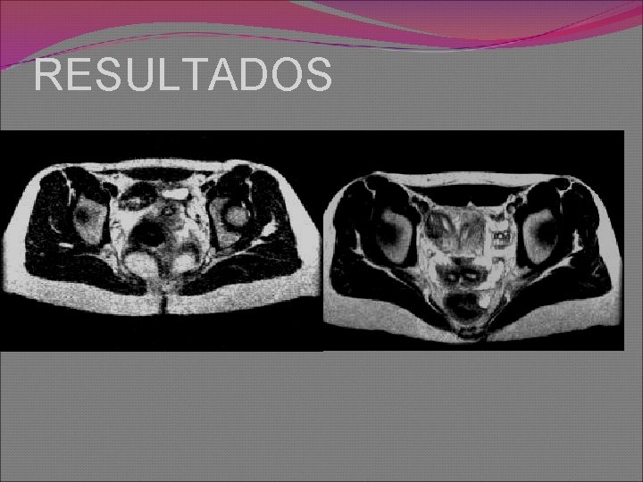 RESULTADOS 