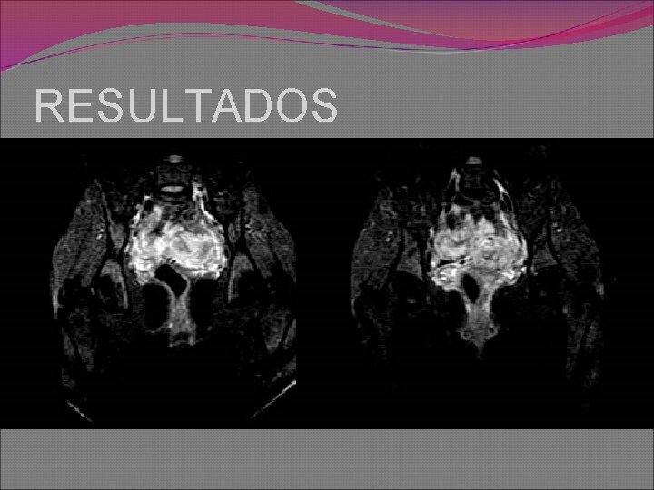 RESULTADOS 