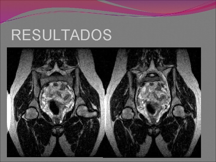 RESULTADOS 