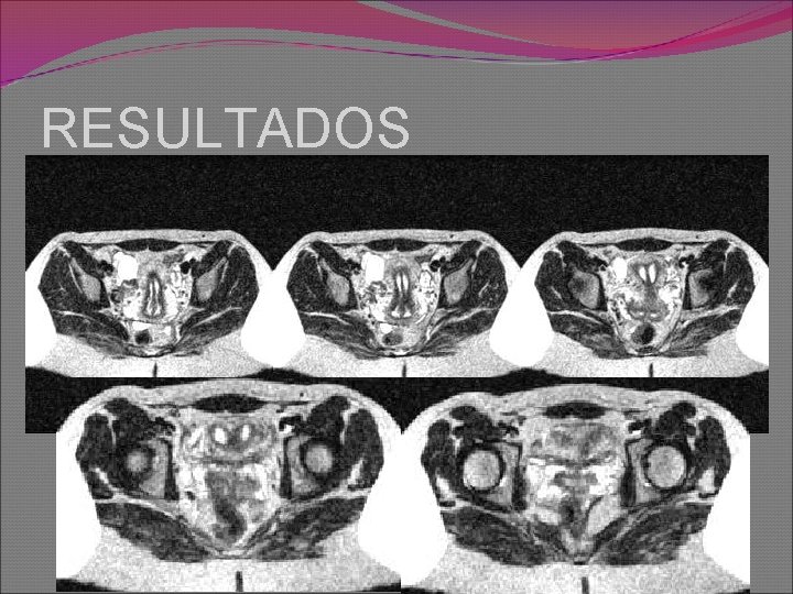 RESULTADOS 