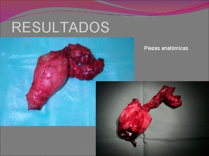 RESULTADOS Piezas anatómicas 