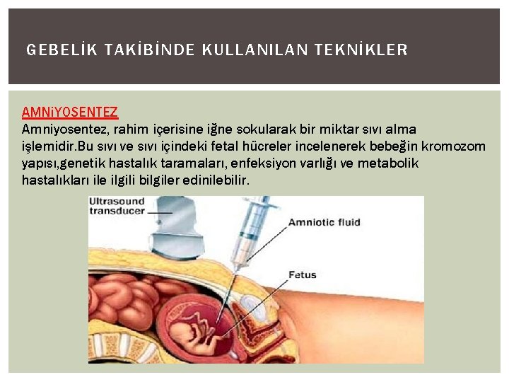 GEBELİK TAKİBİNDE KULLANILAN TEKNİKLER AMNi. YOSENTEZ Amniyosentez, rahim içerisine iğne sokularak bir miktar sıvı