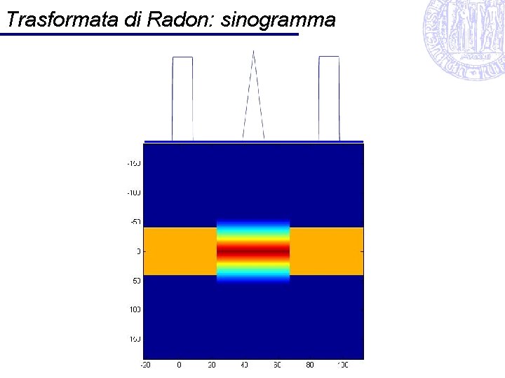 Trasformata di Radon: sinogramma 