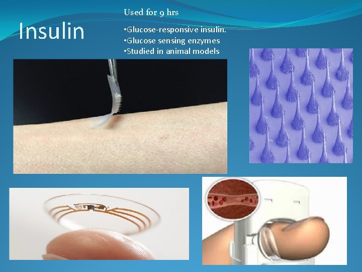 Insulin Used for 9 hrs • Glucose-responsive insulin. • Glucose sensing enzymes • Studied