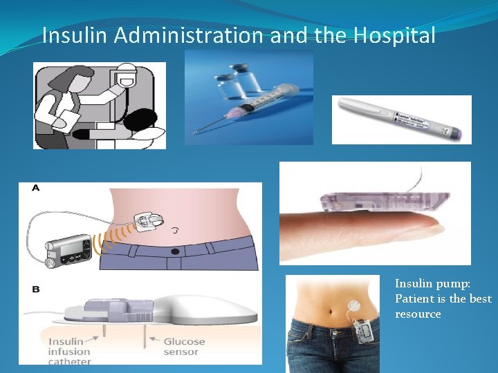 Insulin Administration and the Hospital Insulin pump: Patient is the best resource 