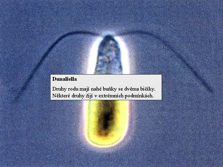 Dunaliella Druhy rodu mají nahé buňky se dvěma bičíky. Některé druhy žijí v extrémních
