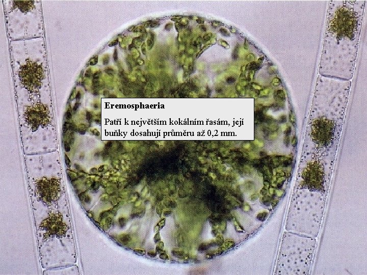 Eremosphaeria Patří k největším kokálním řasám, její buňky dosahují průměru až 0, 2 mm.