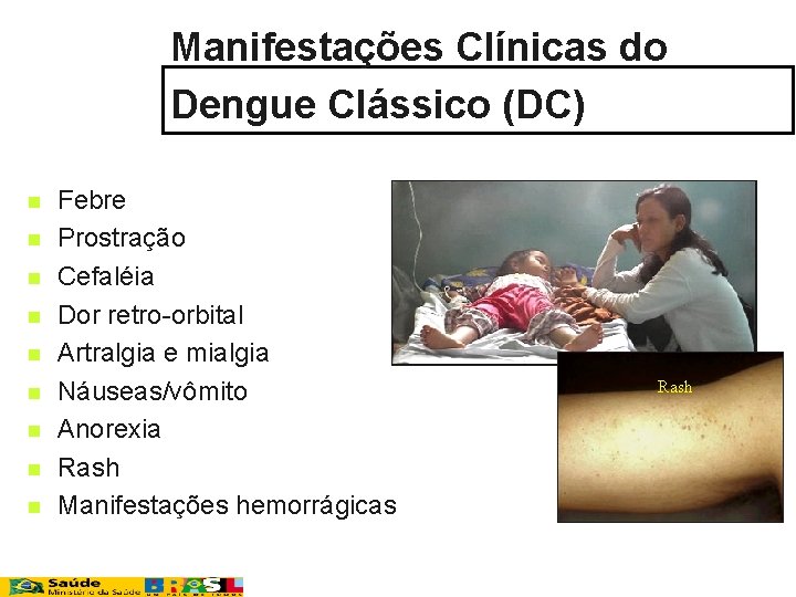 Manifestações Clínicas do Dengue Clássico (DC) n n n n n Febre Prostração Cefaléia