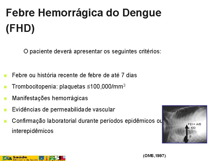 Febre Hemorrágica do Dengue (FHD) O paciente deverá apresentar os seguintes critérios: n Febre