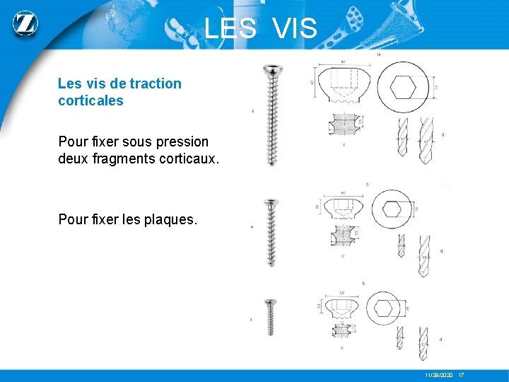 LES VIS Les vis de traction corticales Pour fixer sous pression deux fragments corticaux.