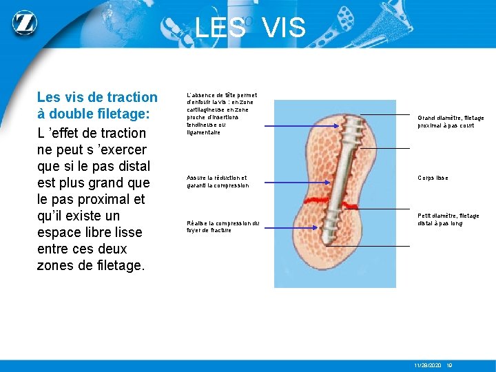 LES VIS L’absence de tête permet Les vis de traction d’enfouir la vis :