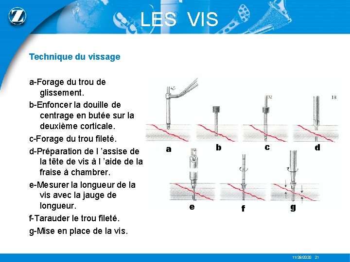 LES VIS Technique du vissage a-Forage du trou de glissement. b-Enfoncer la douille de