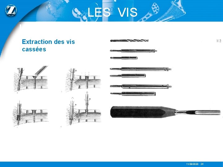 LES VIS Extraction des vis cassées 11/28/2020 24 