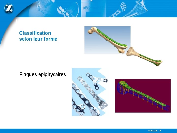 LES PLAQUES Classification selon leur forme Plaques épiphysaires 11/28/2020 26 