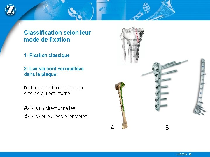 LES PLAQUES Classification selon leur mode de fixation 1 - Fixation classique 2 -