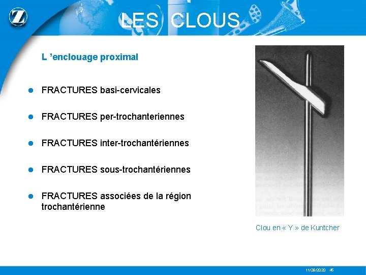 LES CLOUS L ’enclouage proximal l FRACTURES basi-cervicales l FRACTURES per-trochanteriennes l FRACTURES inter-trochantériennes