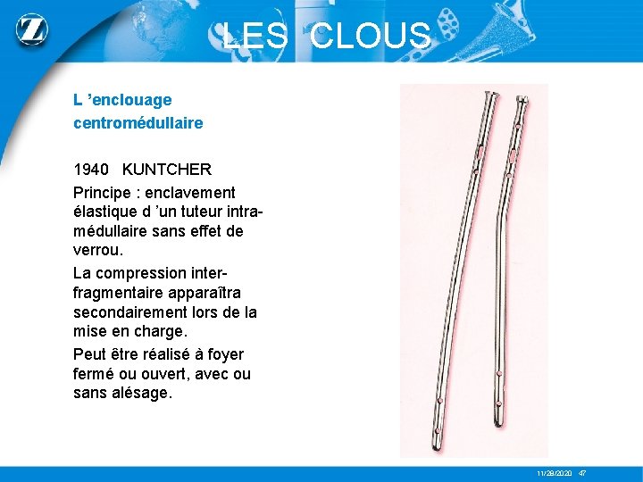 LES CLOUS L ’enclouage centromédullaire 1940 KUNTCHER Principe : enclavement élastique d ’un tuteur