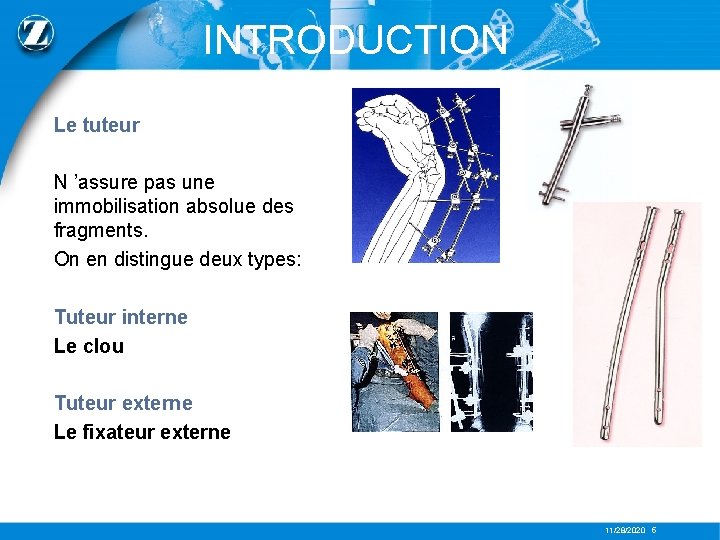 INTRODUCTION Le tuteur N ’assure pas une immobilisation absolue des fragments. On en distingue