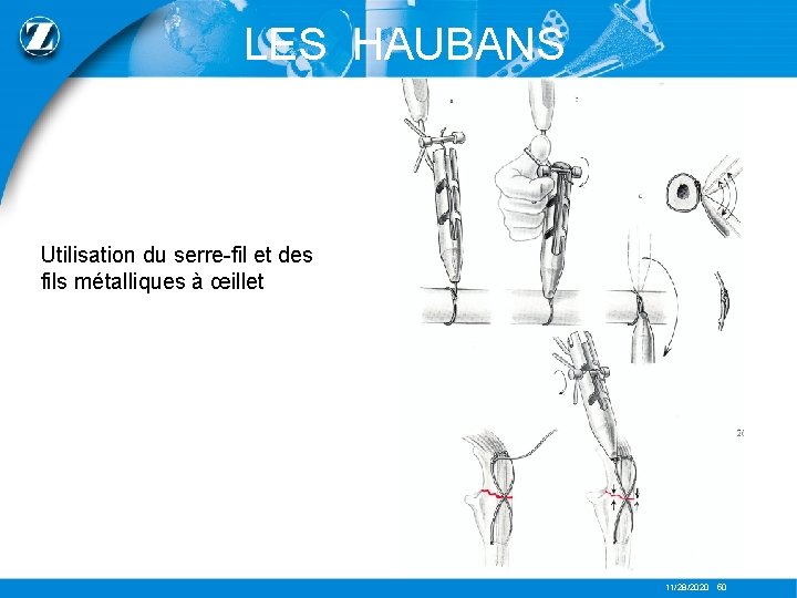 LES HAUBANS Utilisation du serre-fil et des fils métalliques à œillet 11/28/2020 50 