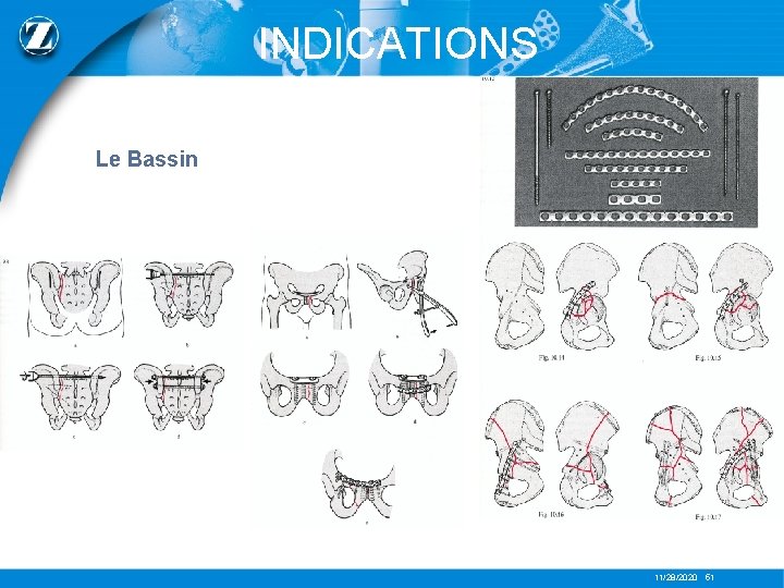 INDICATIONS Le Bassin 11/28/2020 51 