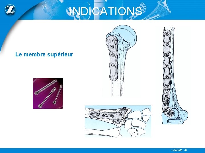 INDICATIONS Le membre supérieur 11/28/2020 53 