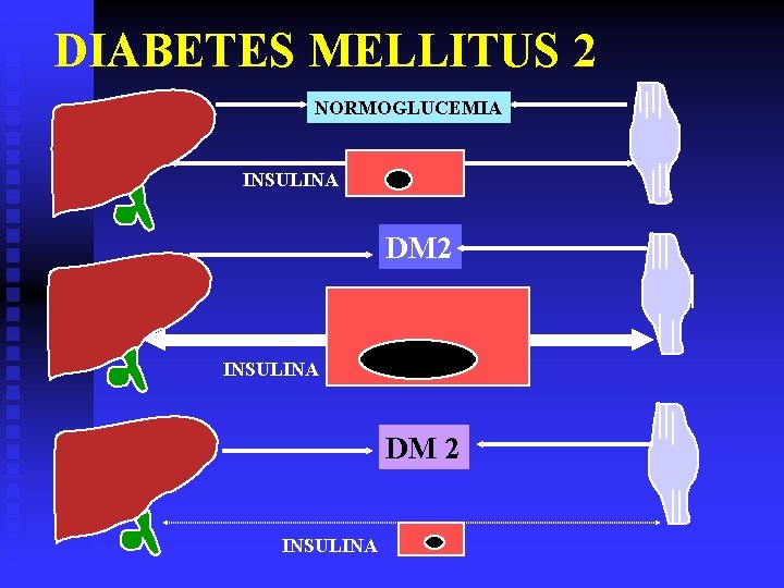DIABETES MELLITUS 2 NORMOGLUCEMIA INSULINA DM 2 INSULINA 