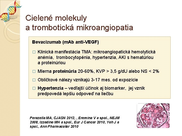 Cielené molekuly a trombotická mikroangiopatia Bevacizumab (m. Ab anti-VEGF) � Klinická manifestácia TMA: mikroangiopatická