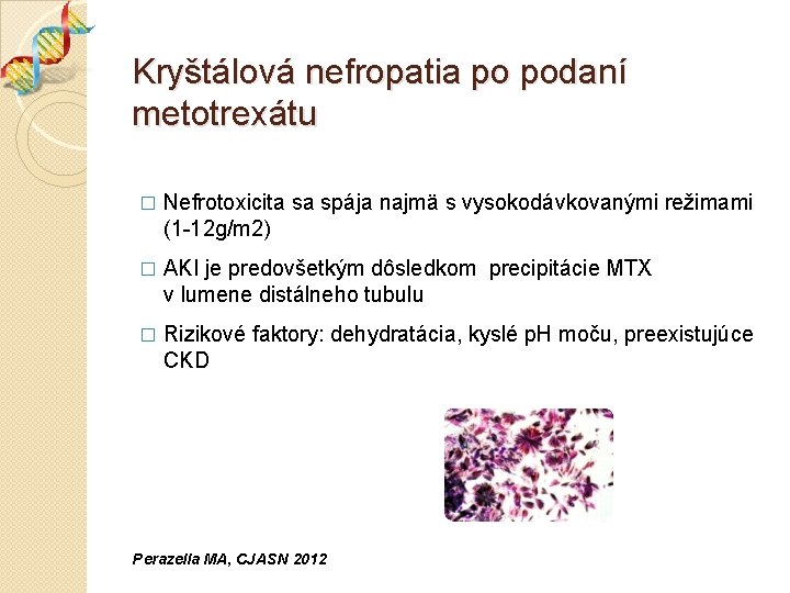 Kryštálová nefropatia po podaní metotrexátu � Nefrotoxicita sa spája najmä s vysokodávkovanými režimami (1