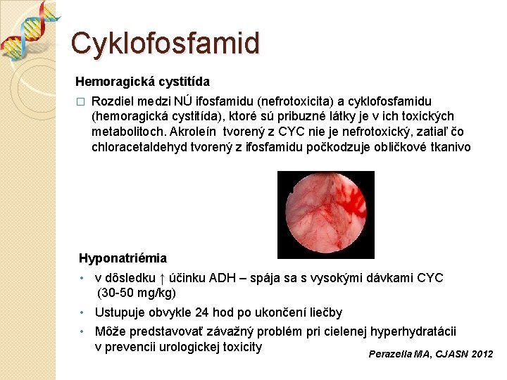 Cyklofosfamid Hemoragická cystitída � Rozdiel medzi NÚ ifosfamidu (nefrotoxicita) a cyklofosfamidu (hemoragická cystitída), ktoré