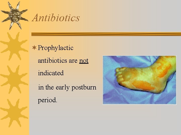Antibiotics ¬ Prophylactic antibiotics are not indicated in the early postburn period. 