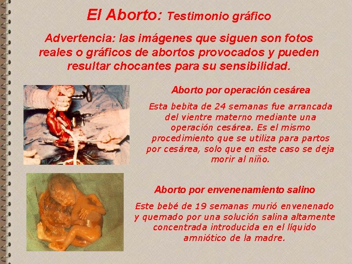 El Aborto: Testimonio gráfico Advertencia: las imágenes que siguen son fotos reales o gráficos